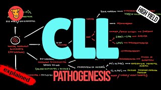 CHRONIC LYMPHOCYTIC LEUKEMIA Pathogenesis CLL Criteria Diagnosis Treatment [upl. by Keg34]