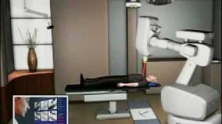 Cyberknife Redefines Radiation Treatment Phoenix Cyberknife amp Radiation Oncology Center [upl. by Eitsud]