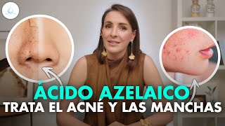 🔴 MILAGROSO ACIDO AZELAICO ¡NO MÁS MANCHAS ROSACEA y ACNÉ drapilarochoa  Dermatologa [upl. by Ainnek379]