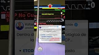 🫡 Monitoreo Fisiológico de la RCP…😮 Gasto Cardiaco Derecho e Izquierdo 😮 ¿lo sabías [upl. by Ilagam204]