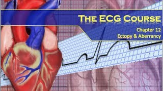 The ECG Course  Ectopy amp Aberrancy [upl. by Ennazus70]