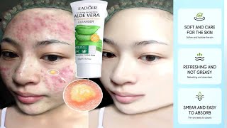 Sadoer aloe vera cleanser clean pores  smooth skin  Remove dead skin  Aloe Vera daily face wash [upl. by Darleen]