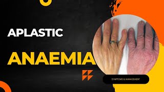 APLASTIC ANEMIA  MALAYALAM  PATHOLOGY  CAUSES  SYMPTOMS  DIAGNOSIS  TREATMENT [upl. by Faith]