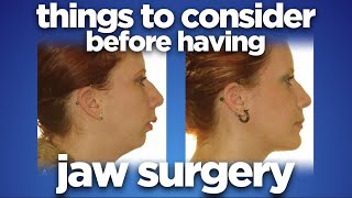 Things to consider before having jaw surgery by dr Mike Mew [upl. by Raphaela19]