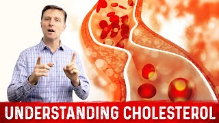 How to Read and Understand Your Cholesterol Levels [upl. by Nabla]