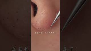 Your face should be clean velvethair blackhead immersiveskincare deepporecleansing skin [upl. by Annora795]