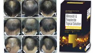 Minoxyqure F Minoxidil amp Finasteride Topical Solution [upl. by Gunzburg597]