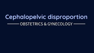 Obstetrics Cephalopelvic disproportion [upl. by Hendon]