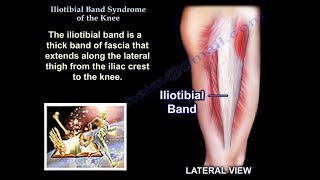 Iliotibial Band Syndrome Of The Knee  Everything You Need To Know  Dr Nabil Ebraheim [upl. by Felton]