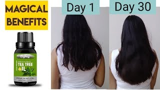 Tea Tree Oil For Hair Growth Benefits of Tea tree oil Tea tree oil Review [upl. by Assirrec]