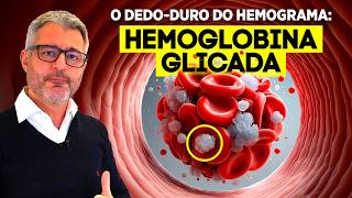 Para que serve o exame de hemoglobina glicada [upl. by Ssitnerp]