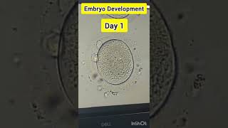 Embryo development process in IVF embryology embryodevelopment embryologist ivf ivfprocess [upl. by Diao]