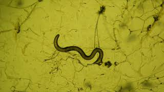 fungal predators of nematode worms [upl. by Marci907]