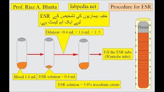 ESR VS CRP by Prof Riaz A Bhutta labpedianet Urdu Hindi [upl. by Essila]