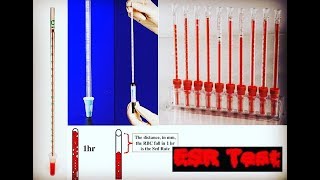 Erythrocyte Sedimentation Rate ESR Test [upl. by Gennie]