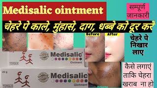 Medisalic ointment cream uses side effects [upl. by Ideih]