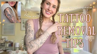 Tattoo Removal Tips  4 month update [upl. by Germann]