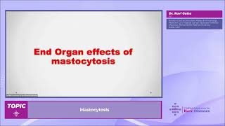 Dr Ravi Gutta  Mastocytosis [upl. by Karia]