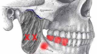 Masseter Muscle Assessment [upl. by Atauqal776]