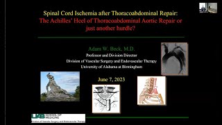 “Spinal Cord Ischemia The Achilles’ Heel of Thoracoabdominal Aortic Repair or Just Another Hurdle” [upl. by Calli]