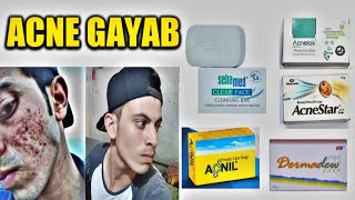 Top 5 Best Soaps For Acne Pimples Available In India  Best Soap For Acne Pimples [upl. by Zerat]