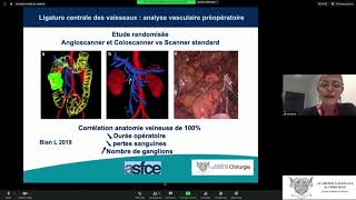 Technique de lexérèse complète du mésocolon par voie laparoscopique pour cancer du colon droit [upl. by Soalokcin]