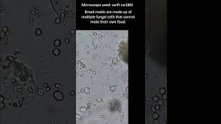 How does mold spread Bread Mold under the microscope microscopy [upl. by Eentihw]