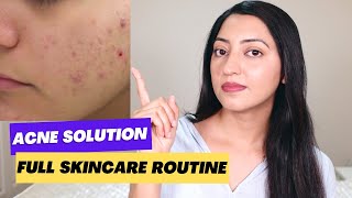 Complete Skincare Routine for Acne [upl. by Annaeg303]