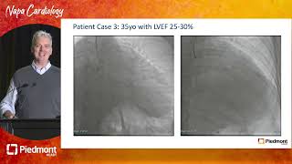 Appraisal of Successes and Shortfalls in CTO Revascularization [upl. by Kcirdnekal500]