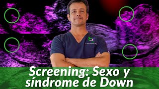 Ultrasonido 12 semanas Sexo y síndrome de Down Screening Primer Trimestre de embarazo [upl. by Hjerpe490]