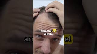 🌟👀 ¿Te Arrancas Pelos ➡️ Qué es la Tricotilomanía 3 Síntomas Clave tricotilomanía pelo cabello [upl. by Nlyak]