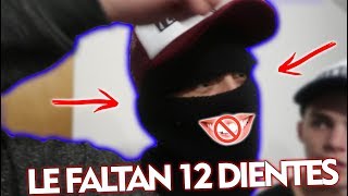 LE FALTAN 12 DIENTES confiesa su gran secreto [upl. by Doretta]