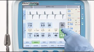 fabian HFO SIPPV Synchronized Intermittent Positive Pressure Ventilation [upl. by Laughton]