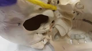 External Occipital Bone [upl. by Chaunce236]