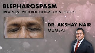 Understanding Blepharospasm Treatment  Botulinum Toxins Dr Akshay Nair Mumbai [upl. by Novyaj501]