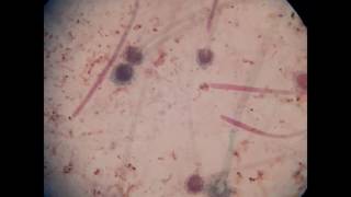 FUNGAL HYPHAE amp MYCELIA [upl. by Eemaj]