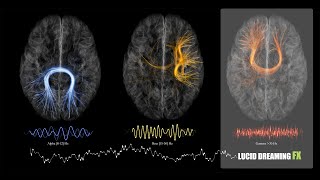 lucid dreaming techniques  Harvard Medical School [upl. by Ehsom116]