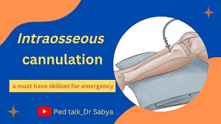 Intraosseous cannulation Putting an IO line Emergency circulatory access Skills in pediatrics [upl. by Xymenes]