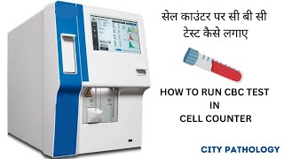 CBC TEST CELL COUNTER PAR KAISE LAGAYEN सी बी सी टेस्ट कैसे लगाएं [upl. by Paquito]