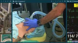 Anesthesia Sample Case Management Instructional Video [upl. by Declan]