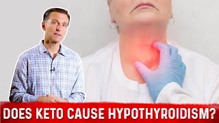 Does the Ketogenic Diet Cause Hypothyroidism or Hashimoto’s Thyroiditis – Dr Berg [upl. by Akienahs]