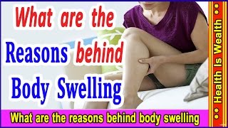 शरीर मे सूजन किन कारणों से आती है  what are the reason behind body swelling [upl. by Francois]