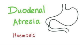 Duodenal Atresia Mnemonic [upl. by Ennovaj256]