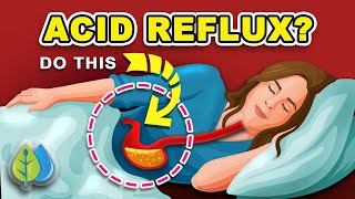 3 Ways to Stop ACID REFLUX Naturally  How to Stop Acid Reflux amp HEARTBURN [upl. by Warfore]