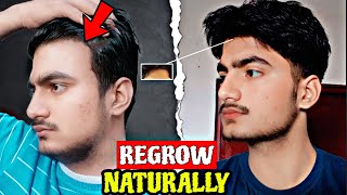 How to stop Hair loss amp Regrow your hairs in 3 months [upl. by Innis326]