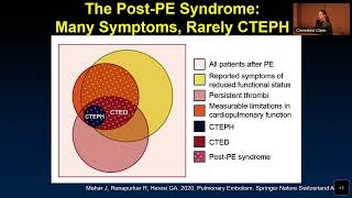 Chronic Thromboembolic PH Alice Goyanes MD [upl. by Niriam]