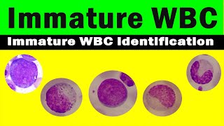 How to differentiate immature WBC  immature WBC identification  Hematology [upl. by Cigam]