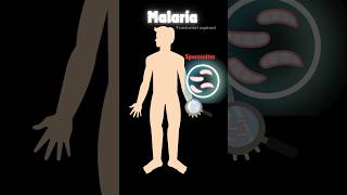 Malaria amp life cycle of plasmodium 🦟 neetbiology humanhealthanddisease neet pw viralshorts [upl. by Barnett]