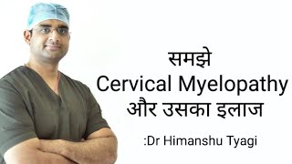 समझे Cervical Myelopathy और उसका इलाज [upl. by Idorb482]