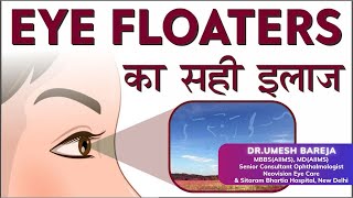 Eye Floaters  Cause amp Treatment  Risks amp Management of Floaters  Dr Umesh Bareja  Eye Specialist [upl. by Brigham947]